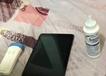 વાયરલેસ સોનોગ્રાફી દ્વારા ભૃણ પરીક્ષણ નો પ્રથમ કિસ્સો સામે આવ્યો