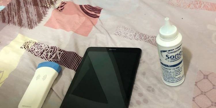 વાયરલેસ સોનોગ્રાફી દ્વારા ભૃણ પરીક્ષણ નો પ્રથમ કિસ્સો સામે આવ્યો