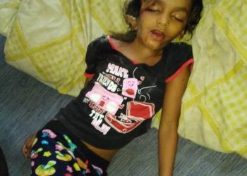 આનંદબાગ વિસ્તાર્ નજીક લીફ્ટમાં ફસાયેલી બાળકી નું મોત,શહેરમા આવી કેટલી લીફટો..?