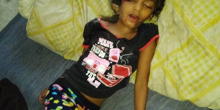 આનંદબાગ વિસ્તાર્ નજીક લીફ્ટમાં ફસાયેલી બાળકી નું મોત,શહેરમા આવી કેટલી લીફટો..?