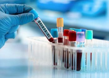 જામનગર સહિત રાજ્યભરમાં લેબોરેટરીની થશે તપાસ