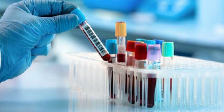 ડીગ્રી વિના 6 માસથી ચાલતી લેબોરેટરીનો પર્દાફાશ