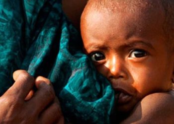 જામનગર અને દ્વારકા જીલ્લામા કુપોષિત બાળકોની સંખ્યા ખબર છે તમને.?