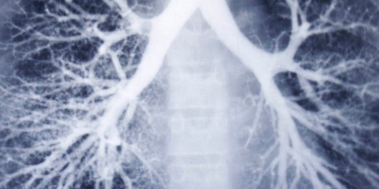 ગુજરાતમાં કોરોનાએ ફેફસાં ડેમેજ કર્યા ! TBમુકત ગુજરાતનાં ટાર્ગેટનું શું થશે ?!