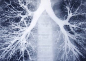 ફટાકડાનો ધુમાડો ફેફસાને કરી શકે છે સીધી અસર, કોરોનામાંથી સાજા થયેલ દર્દીઓ ખાસ ચેતે 