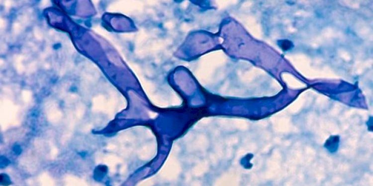 ગુજરાતમાં મ્યુકોરમાઈકોસિસ રોગને મહામારી ઘોષિત કરવામાં આવી, જામનગરમાં આ રોગના કેટલા દર્દી હાલ સારવારમાં વાંચો જે તમે જાણવા માંગો છો