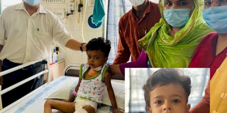અનોખી સર્જરી, 4 વર્ષની કેન્સર પીડિત બાળકીના જડબાની જટિલ સારવાર આ રીતે થઇ