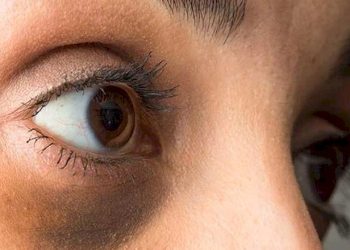 ડાર્ક સર્કલ દૂર કરવા માટે દેશી ઉપચાર ટ્રાય કરી જુવો, વધુ મેકઅપથી કવર કરવાની જરૂર નહીં પડે