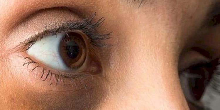 ડાર્ક સર્કલ દૂર કરવા માટે દેશી ઉપચાર ટ્રાય કરી જુવો, વધુ મેકઅપથી કવર કરવાની જરૂર નહીં પડે