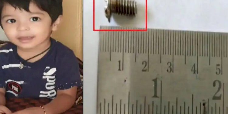 વાલીઓ ચેતો, બાળક રમતો હતો ને સ્ક્રુ નાકમાં ફસાઈ ગયો જો કે…