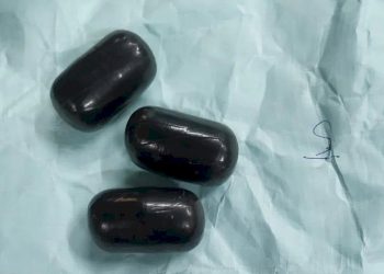 3 લોકોના પેટમાંથી કરોડોનું સોનું મળ્યું…