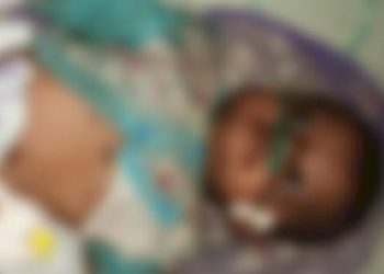 આ તે કેવી અંધશ્રધ્ધા, 2 માસની દીકરીને દેવામાં આવ્યા ધગધગતા ડામ 