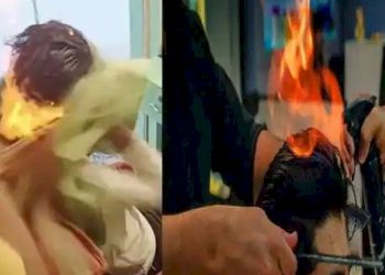 યુવકના માથામાં વાળ કપાવતા લાગી ગઈ આગ 