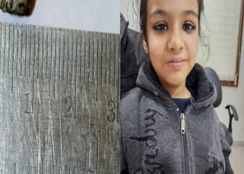 10 વર્ષની બાળકીના નાકમાં 3 માસથી ફસાયેલ હતો રબ્બરનો ટુકડો પછી…