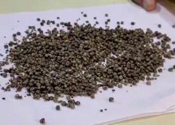 2 કલાકની સર્જરીમાં તબીબોએ નાની મોટી 1600 પથરીઓ યુવકના શરીરમાંથી કાઢી