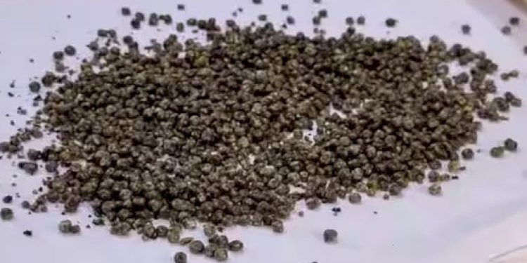 2 કલાકની સર્જરીમાં તબીબોએ નાની મોટી 1600 પથરીઓ યુવકના શરીરમાંથી કાઢી