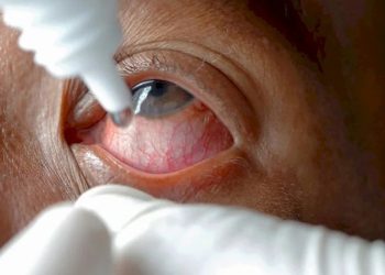 ‘આ’ પ્રવાહીને કારણે વૃદ્ધે દ્રષ્ટિ ગુમાવી ! રૂ.8 લાખનું વળતર