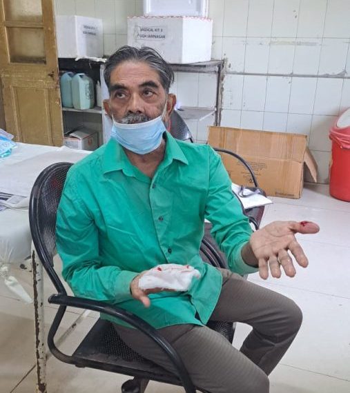 કૂતરાંનો ત્રાસ : જામનગરની જીજી હોસ્પિટલનું તંત્ર સંપૂર્ણ રેઢીયાળ..!