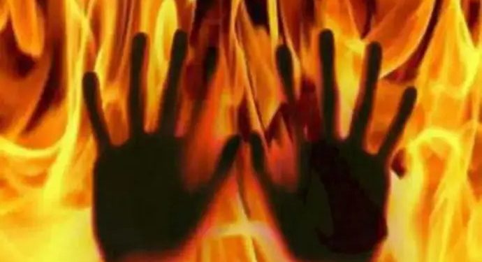 ઓખામાં નવપરિણીત યુવાને કેરોસીન છાંટીને દીવાસળી ચાંપ્યા બાદ પત્ની સાથે બાથ ભીડી